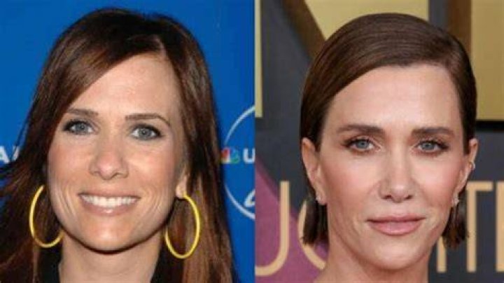 Kristen Wiig Plastic Surgery Before and After